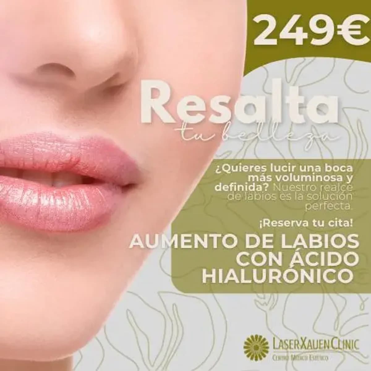 Aumento de Labios con Ácido Hialurónico - Volumen y Perfilado
