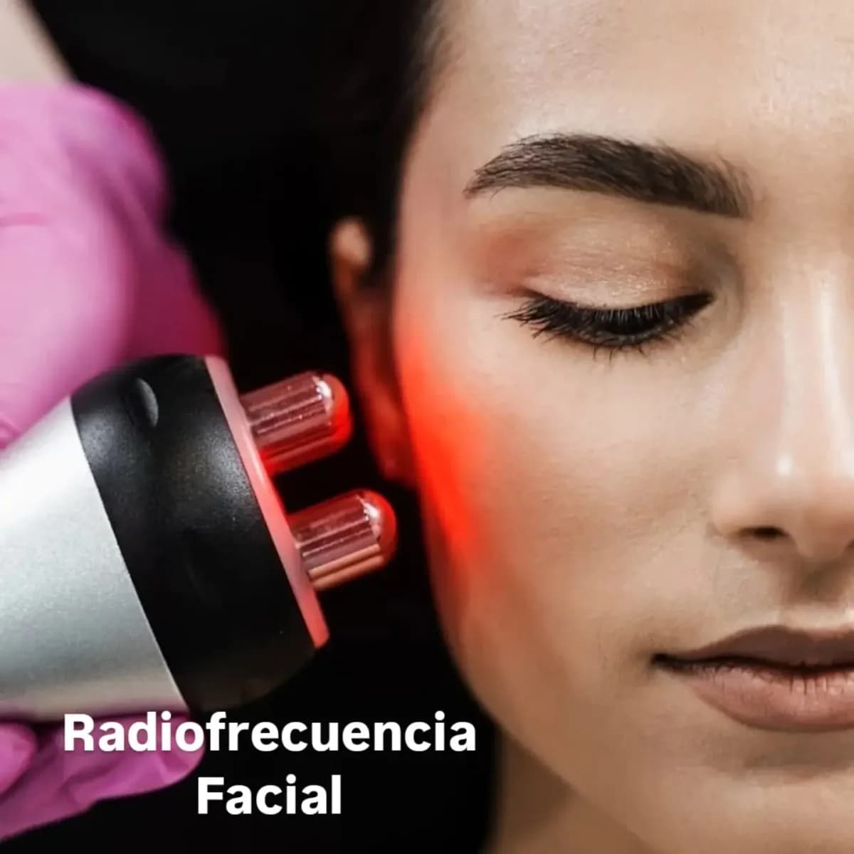 Radiofrecuencia Facial