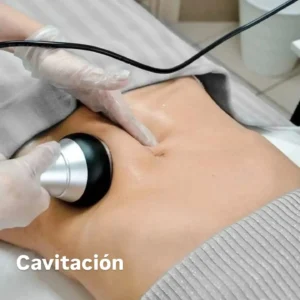 Cavitación